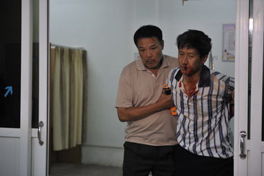 张国强《永远的忠诚》遭外村殴打 流血照曝光