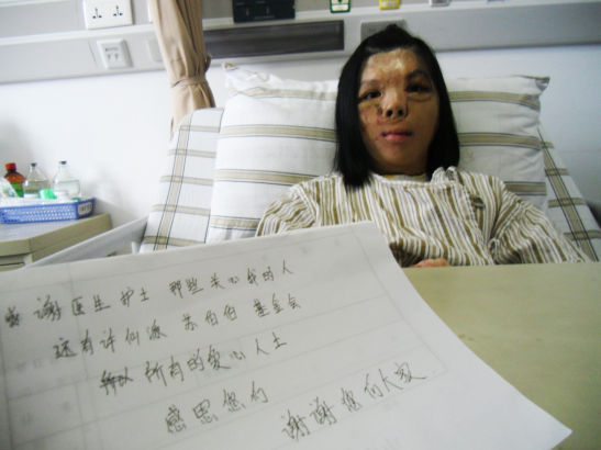 福建首例中国式换脸术成功_新浪健康_新浪网