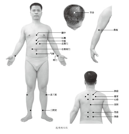 胃溃疡如何用中医艾灸治疗