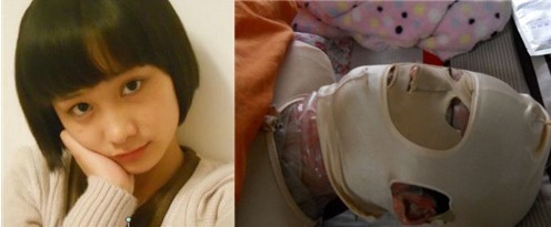 【图为\少女遭毁容事件\的17岁女孩事发前后照