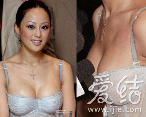 女明星爆乳走光卖弄性感 爱结教你明辨真假胸(2)