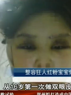 红粉宝宝整容前后照片曝光 红粉宝宝整容前后照片曝光