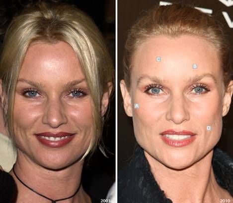 Nicollette Sheridan