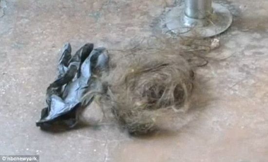 美国<em>女子</em>地铁乘扶梯突晕厥 <em>头发</em>被卡遭截肢|女