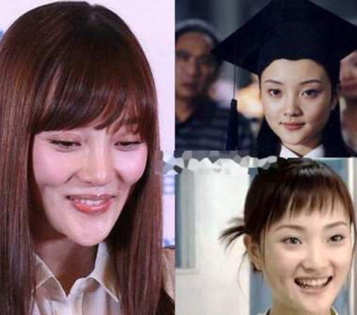 明星整容前和整容后的照片,明星整容前和整容后的照片对比