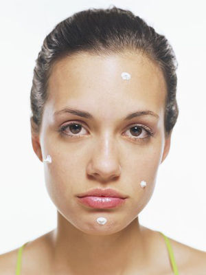 下巴生痘痘且持续一个月不消