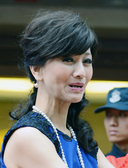 王菲脸部僵硬被指拉皮揭秘明星整容后遗症|明