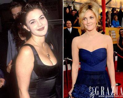 乳房缩水更麻烦