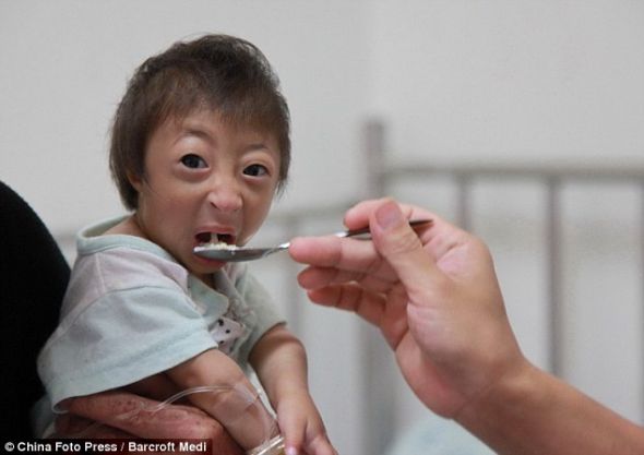 中国3岁幼儿身高54厘米成世界最小女孩