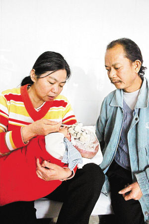 50天婴儿被大火毁容图