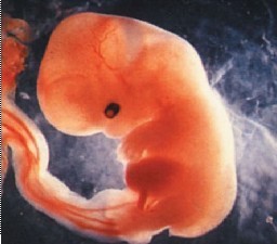 怀孕9周胎儿大小图片