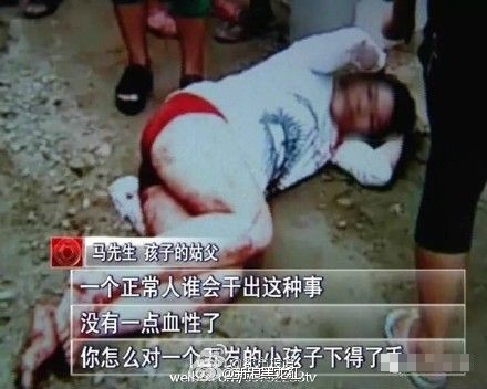 "让老公只爱女儿"胃癌晚期继母刀砍5龄童30多刀