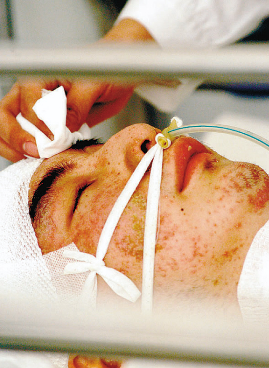 中国医大一院神经外科副主任郭宗泽说,小