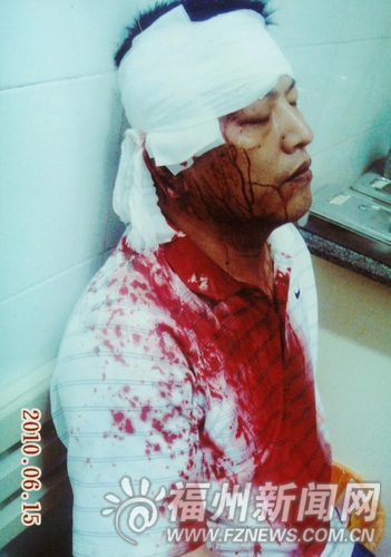 闽侯县青口镇壶山村村支书施洪秋因劝导村民停止龙舟赛,被人打得