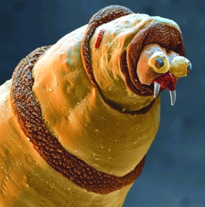显微镜下的螨虫脸上图片