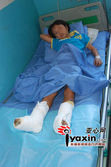 哈密晶华公司烧伤10岁女童 1月前曾烧伤小臭宝