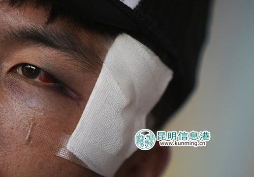 4名男子称被城管打 回应:打人者为协管员 只是认错人