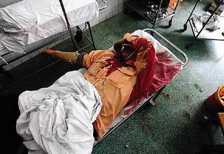 车祸受伤人员在医院接受治疗.