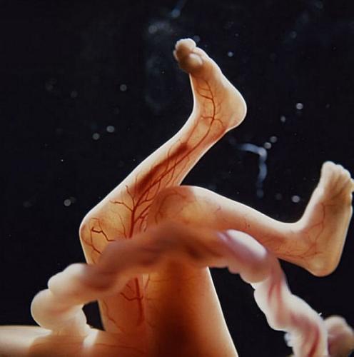 胎儿子宫内发育的震撼照(组图)