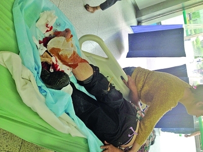 下车时公交车突然启动女乘客脚被轧伤