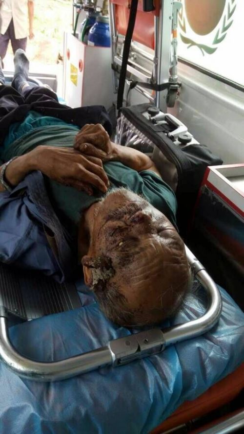 泰安一老人被发现躺在高速路桥下脸上满是血迹