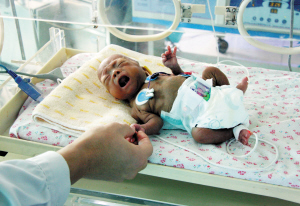 袖珍bb呱呱坠地挺过百日