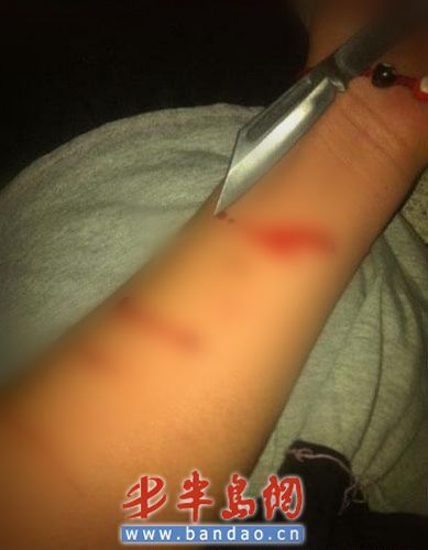 花季女孩网上直播割腕 青岛微博生死营救(图)
