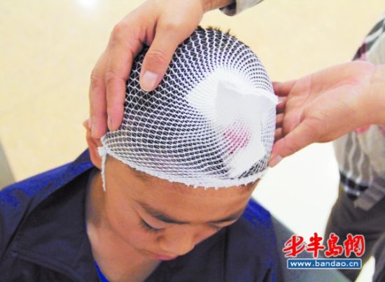 电梯边框大理石板脱落 男孩被砸头破血流(图)