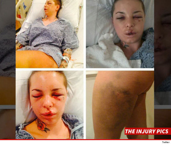 mack)的色情女星曝光了她被拳击手前男友殴打,死里逃生的照片,让人看