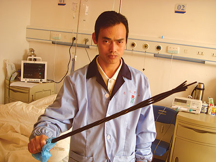 厦门杏林大桥:钢筋刺进工人腹部10余厘米