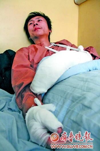 小伙双手被菜刀砍伤后仍摁住诊所窃贼