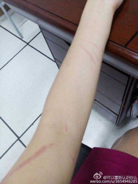 高铁乘务员疑被一家12口围殴全身多处伤口图