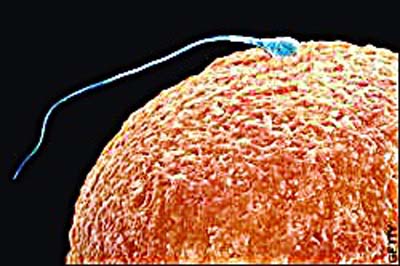 实验室公布的"人造精子"图