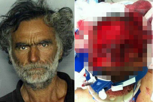 美国女子认出啃脸案受害人是其失散生父