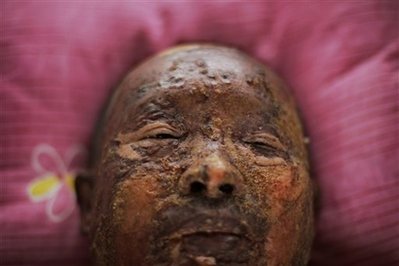 图文:被送至其它城市治疗的中国地震伤员