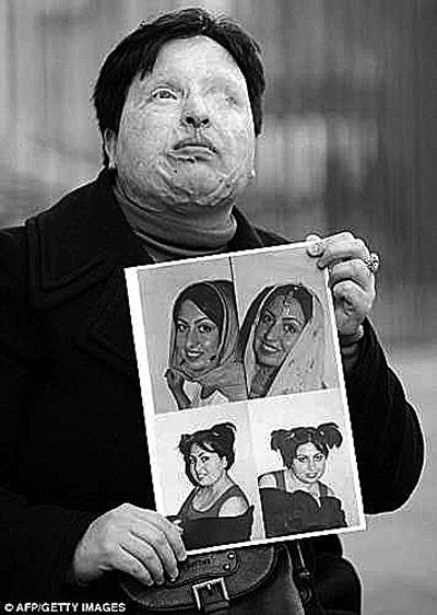手持毁容前旧照的阿米娜资料照片伊朗男子马吉德因向女学生阿米娜脸上