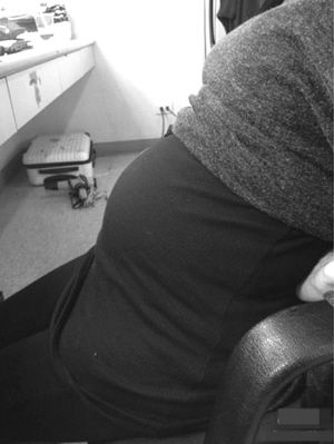 怀孕六个月肚子有多大图片