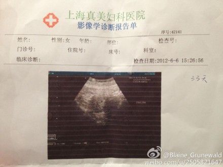 怀孕检查报告单图片