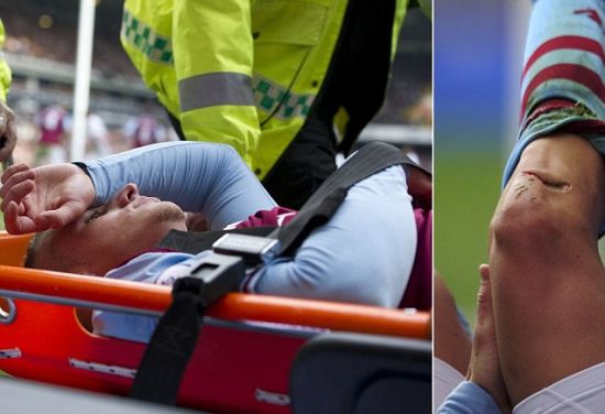 鲁尼式皮肉撕裂 英超悍将腿肉翻开如刀割(慎入)